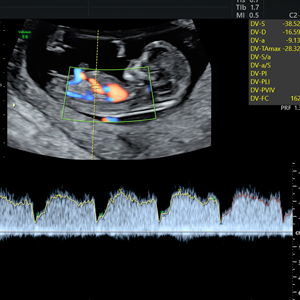 Diagnóstico genético